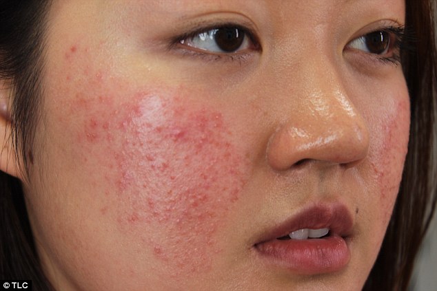 Cảnh báo không thích hợp mỹ phẩm có nguy nan không Cảnh báo không phù hợp mỹ phẩm có gian nguy không