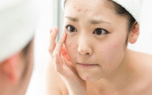 Cách có tác dụng trắng da tự nhiên và thoải mái tuổi dậy thì bình an hiệu quả Cách có tác dụng trắng da tự nhiên tuổi dậy thì an ninh hiệu quả