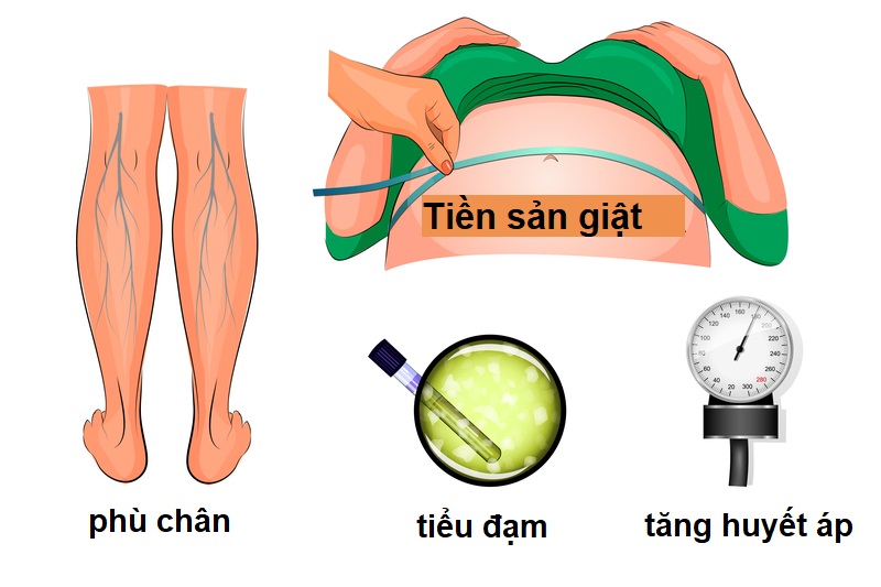 Cách chăm lo thai phụ chi phí sản giật