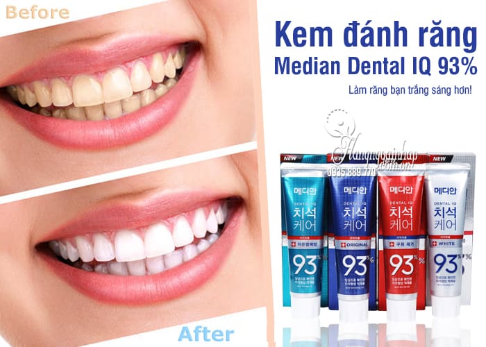 Kem tiến công răng median  median dental iq  hàn quốc