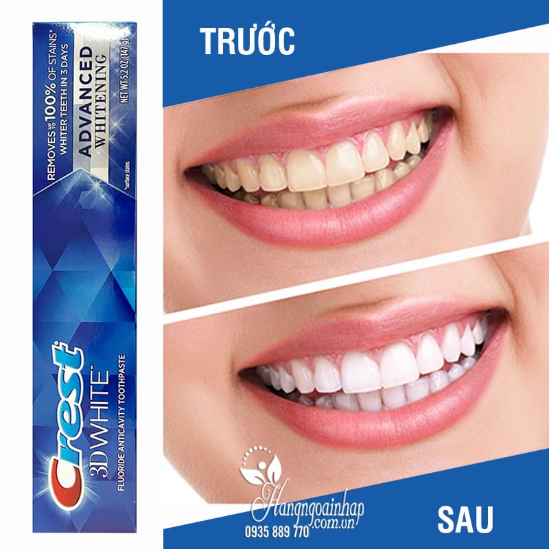 Kem đánh răng crest d trắng g advanced whitening của mỹ