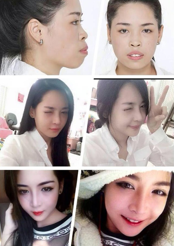 Những cô gái việt dễ thương thần kỳ nhờ vào thẩm mỹ Những cô nàng việt xinh đẹp thần kỳ nhờ thẩm mỹ