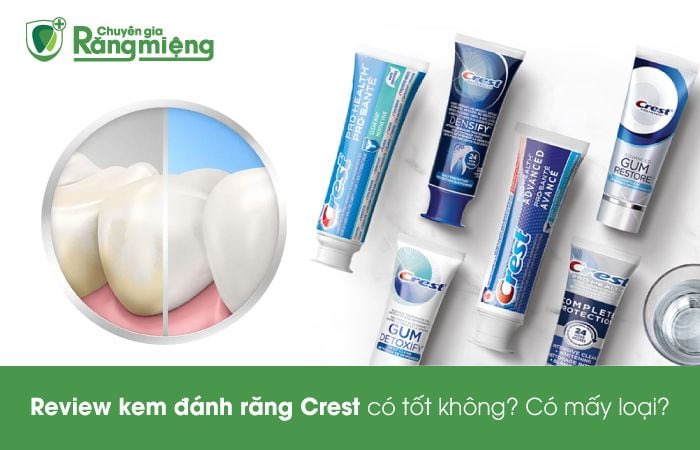 Review những loại kem Đánh răng crest hiện giờ loại nào trắng nhất